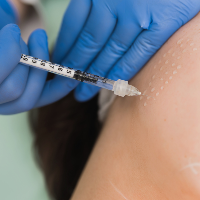 Mesotherapy Needles & Skin Boosters